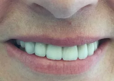 estetica-dental-055